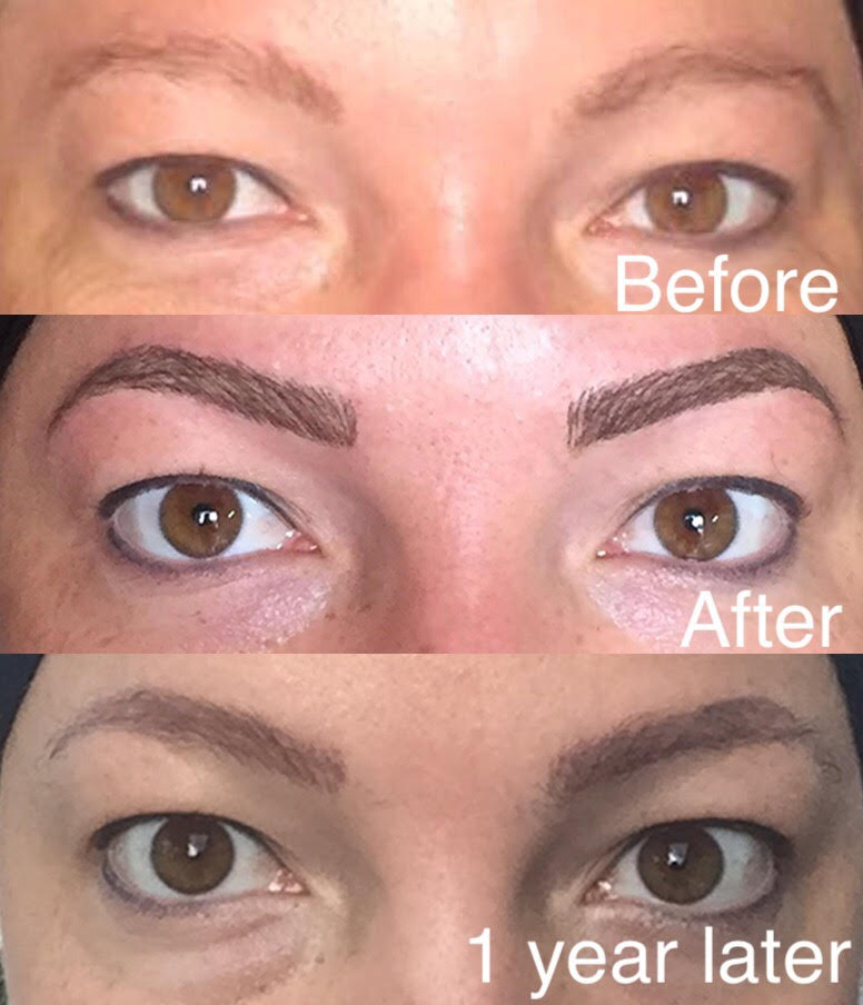 Hair Loss And Microblading Or Micropigmentation HairandNowGlobal   Eyebrows Front On 3 Comparison 