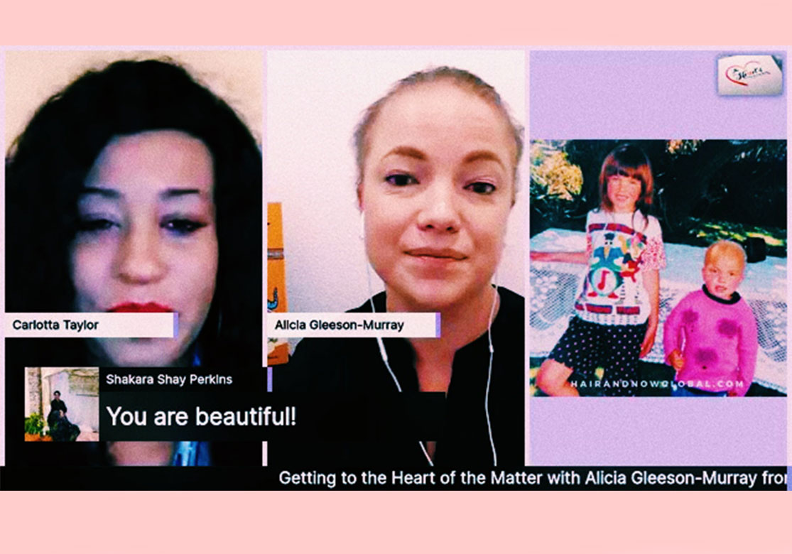 HairandNowGlobal Founder Alopecia Alicia had her first live interview to help spread alopecia and hair loss awareness with Carlotta Taylor on her 'Heart of the Matter' show which focuses on spreading awareness and sharing stories that matter.