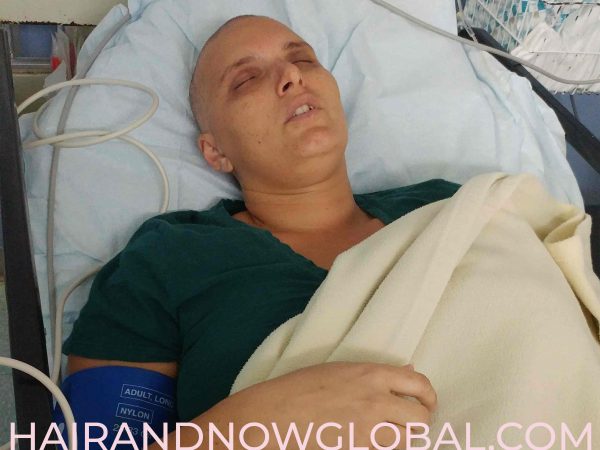 Female-Breast-cancer-victim-in-hospital-bed-with-no-hair
