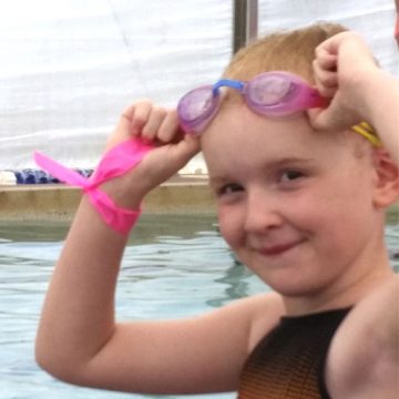 young girl swimming with alopecia monilethrix